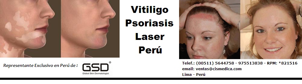 VENTA DE EXCIMER LASER LASER PARA VITILIGO Y SORIASIS PERU 3